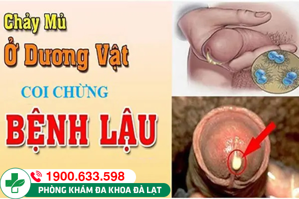 Hình ảnh minh họa